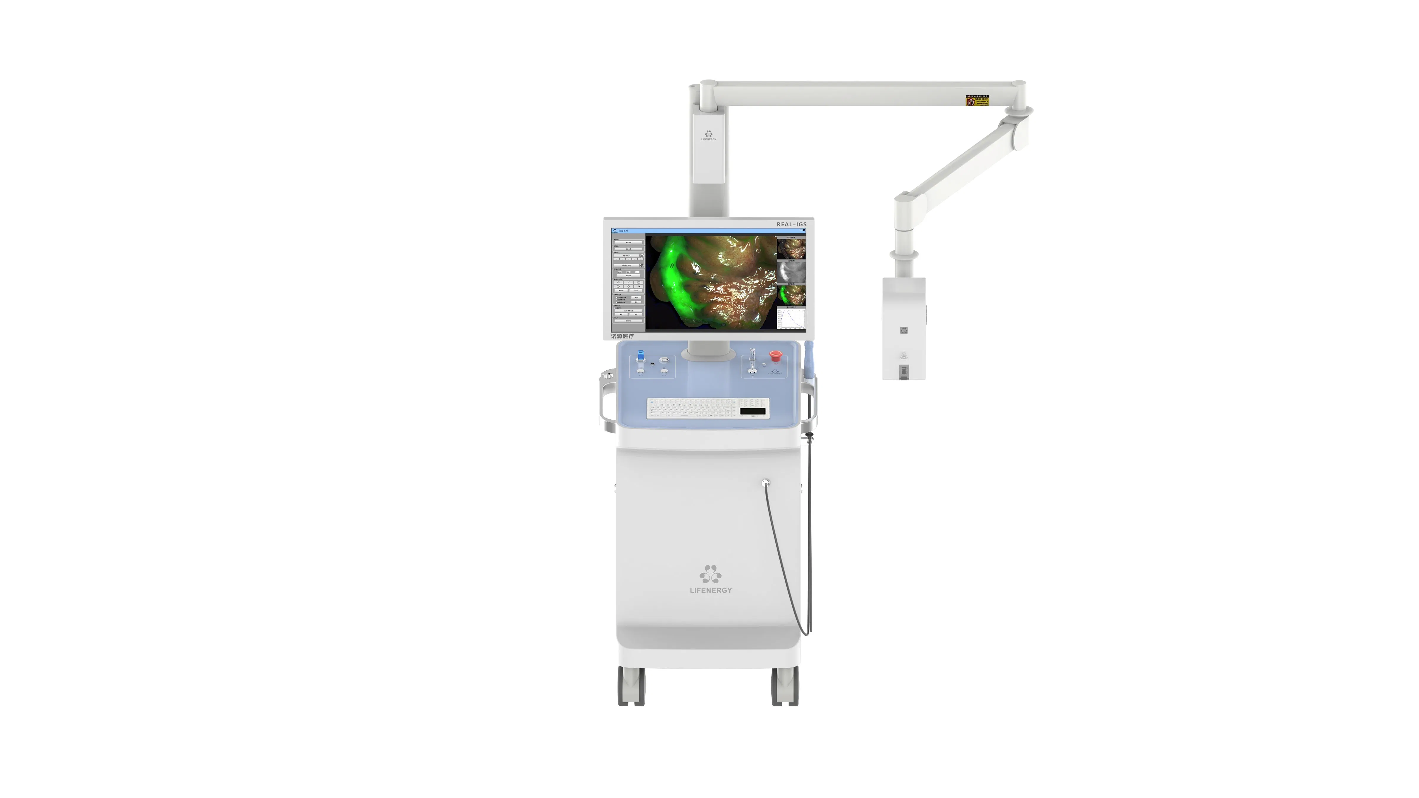 Advanced Fluorescence Imaging Solution for Precise Breast Surgery