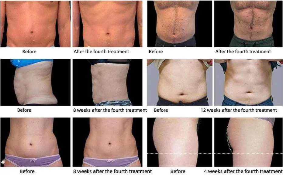 Before and After 1
