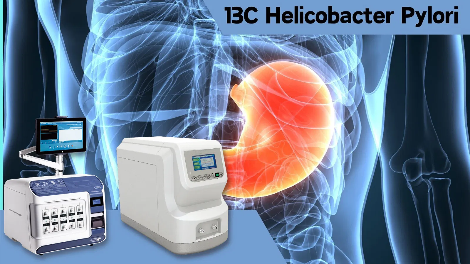 Urea Breath Test Monitoring