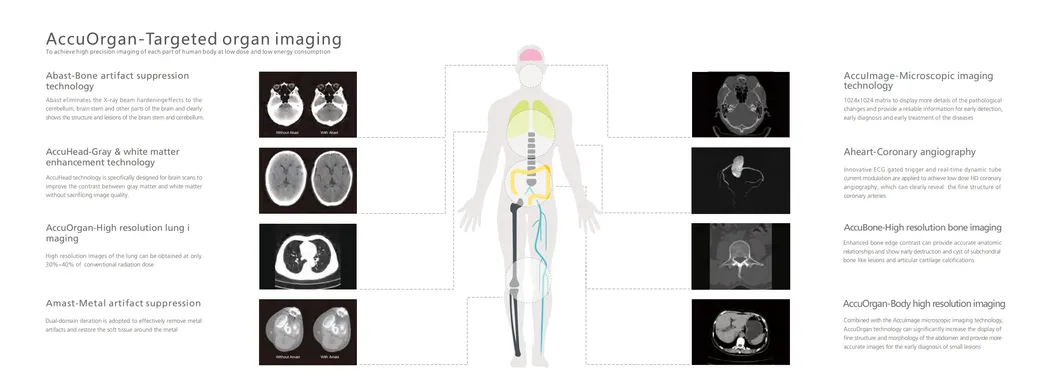 CT Scanner Display 3