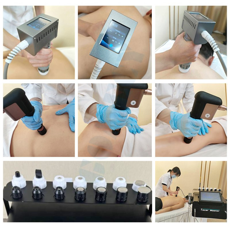Clinical Shockwave Therapy Equipment for Orthopedic Pain and Rehabilitation Use