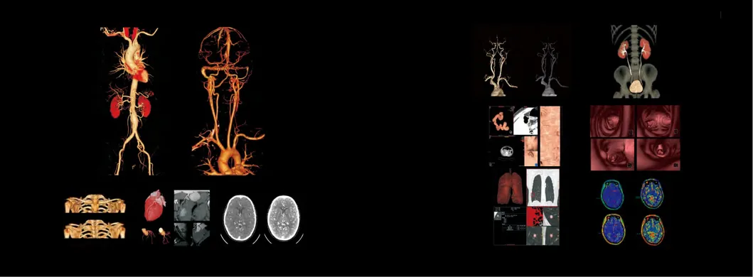 CT Scanner Display 2