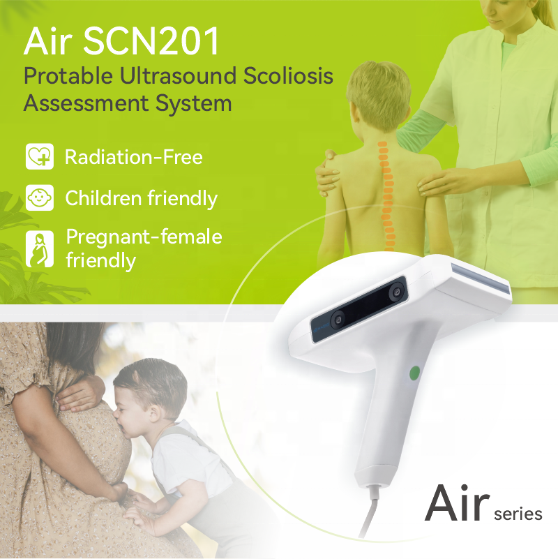 Cobb Angle Measurement Ultrasound Imaging Scanner