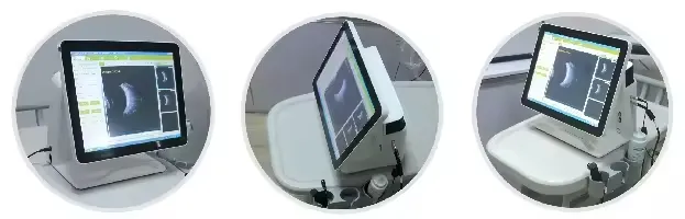 Ultrasound Machine 6