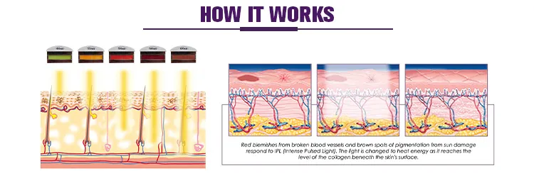Technology Principle