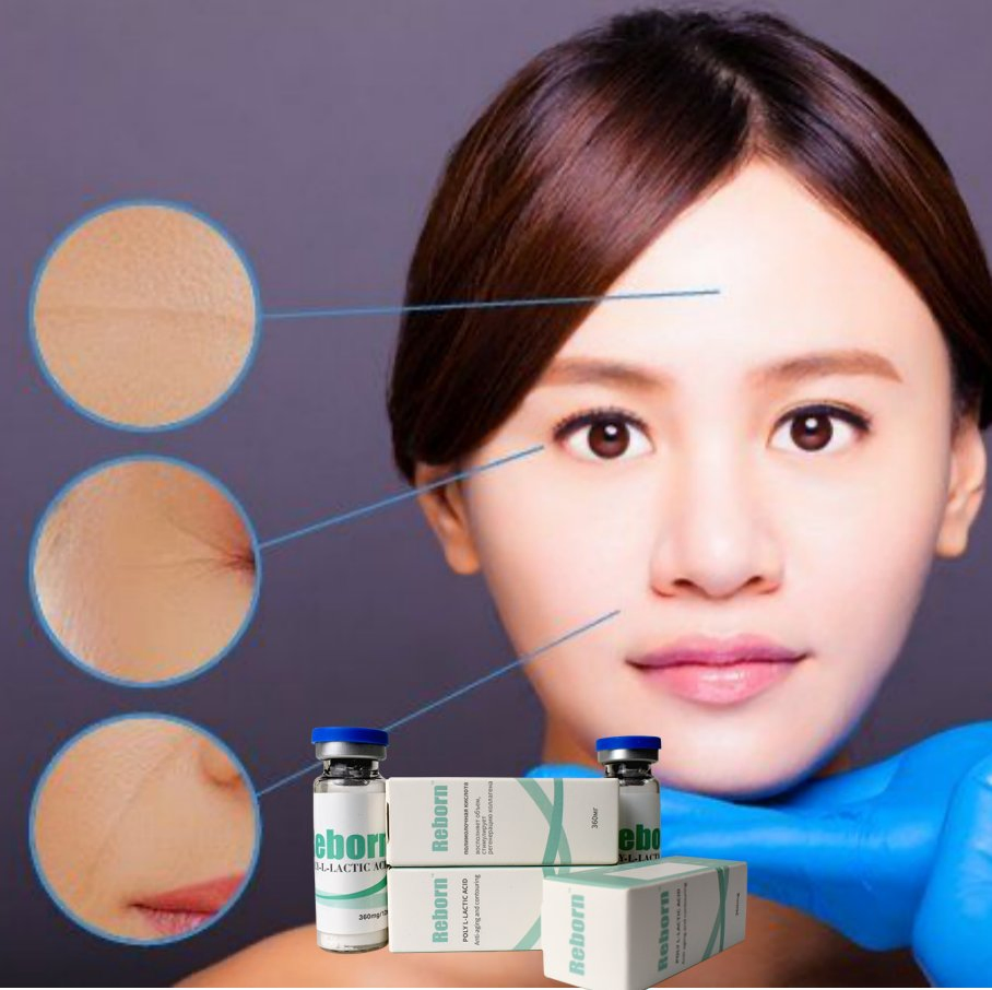 Popular Aesthetics Product Reborn Plla Injectable Dermal Filler 360mg 800mg Optimal Particle Size for Precise and Comfortable Applications