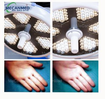 Medical Surgery Hospital Equipment LED Operation Lamp Cold Light Source Operating Light