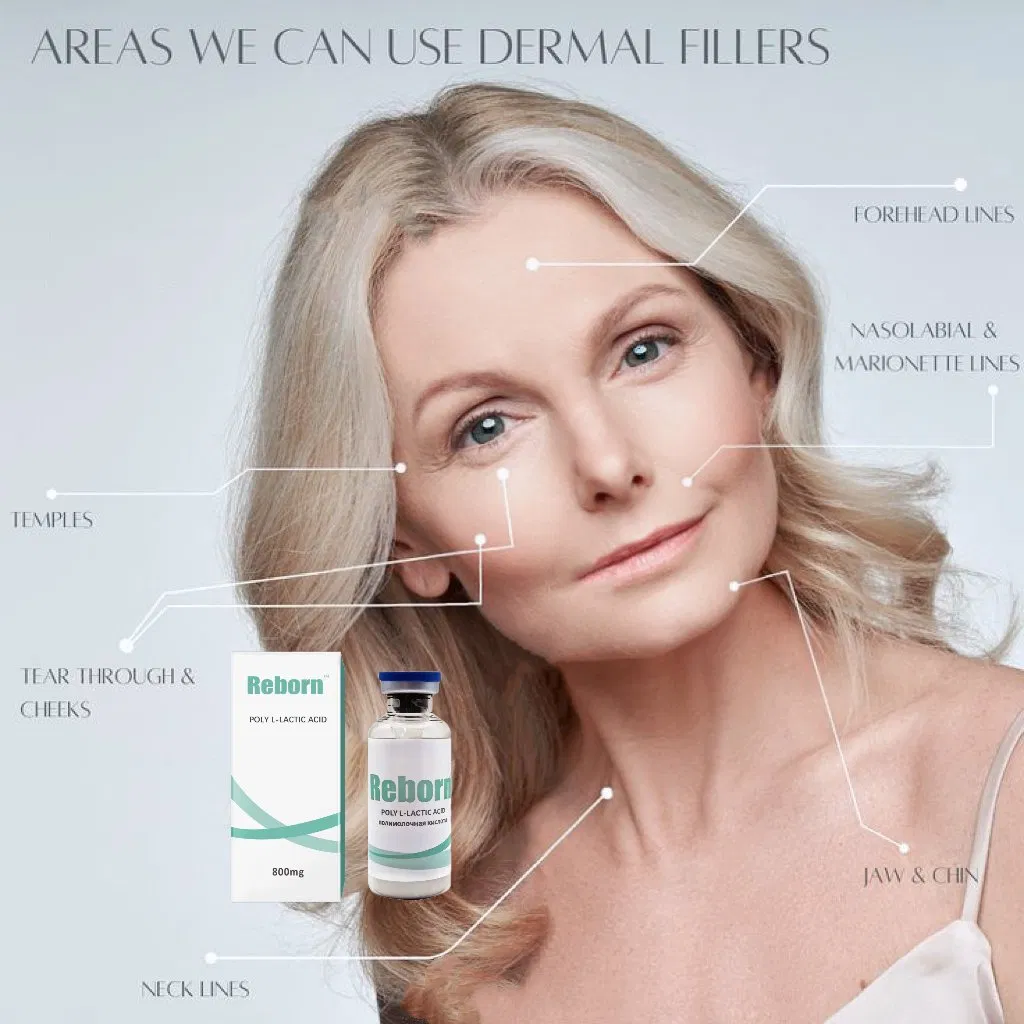 Medical Aesthetics Plla Dermal Filler Biodegradable Polylactic Acid for Long-Lasting Wrinkle Filling and Body Contouring Reborn PLA Injection