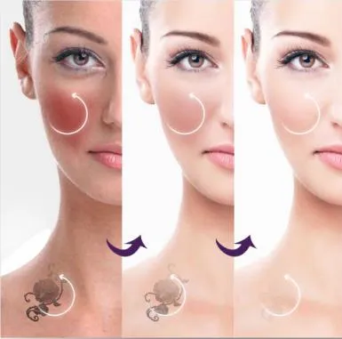 Working Theory Diagram