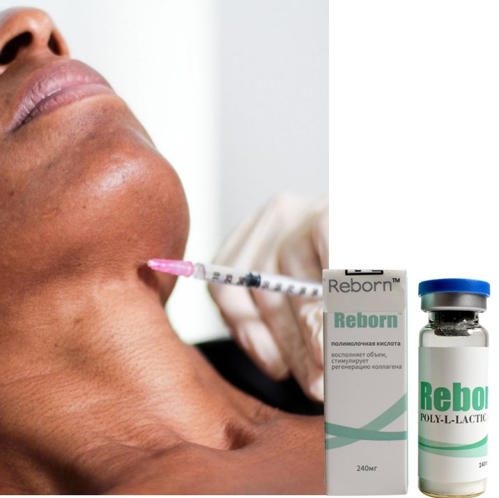 Popular Aesthetics Product Reborn Plla Injectable Dermal Filler 360mg 800mg Optimal Particle Size for Precise and Comfortable Applications