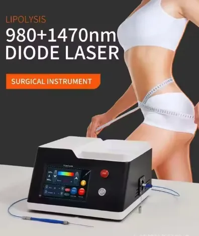 Laser Lipolysis