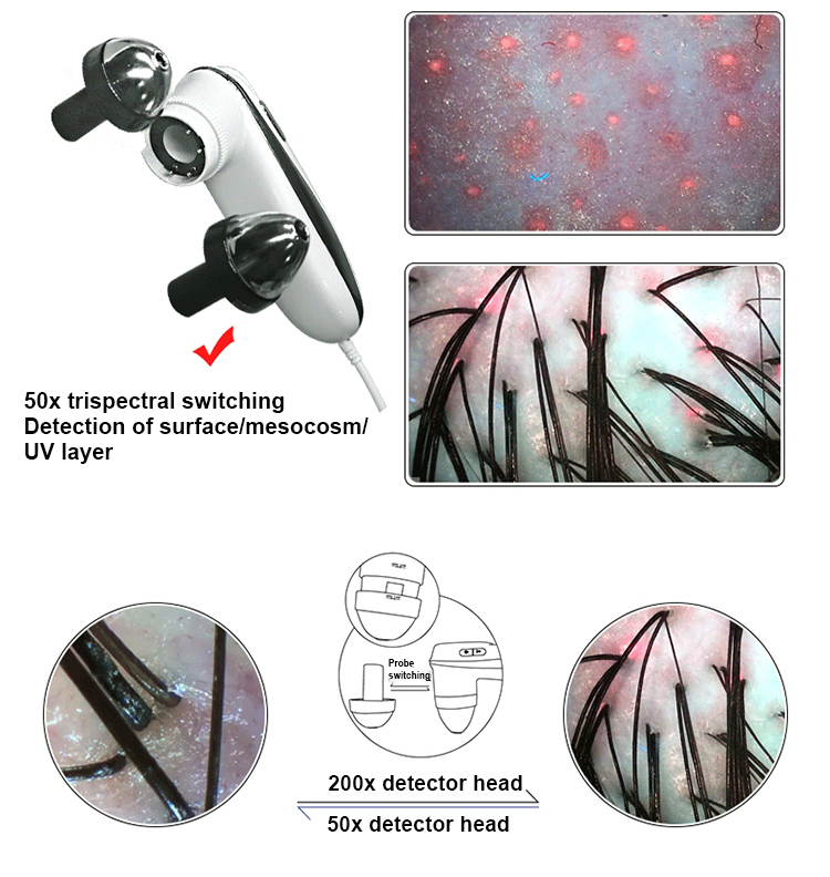 Multifunctional Skin Test Hair Scalp Analyzer Anti Hair Loss Hair Hair Facial Skin Test Skin Analyzer for Beauty Salon Digital Skin Analyzer Hair Scalp Machine