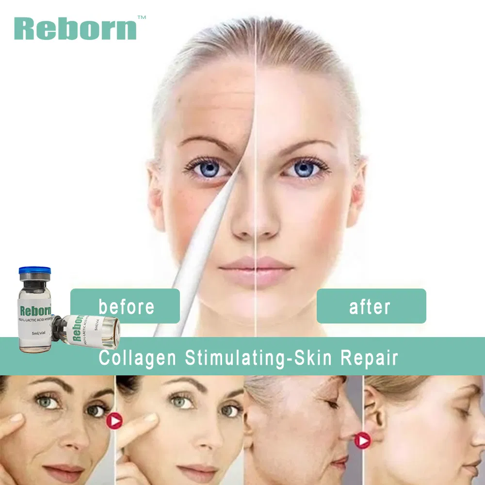 Long Lasting Reborn 5ml Plla Liquid Gel Dermal Filler Skin Booster Stimulates Collagen Production for Face Plastic Surgery Aesthetics Mesotherapy Treatment
