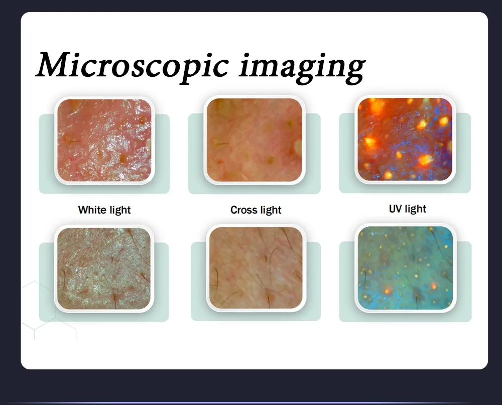 Skin Analysis Detail 3