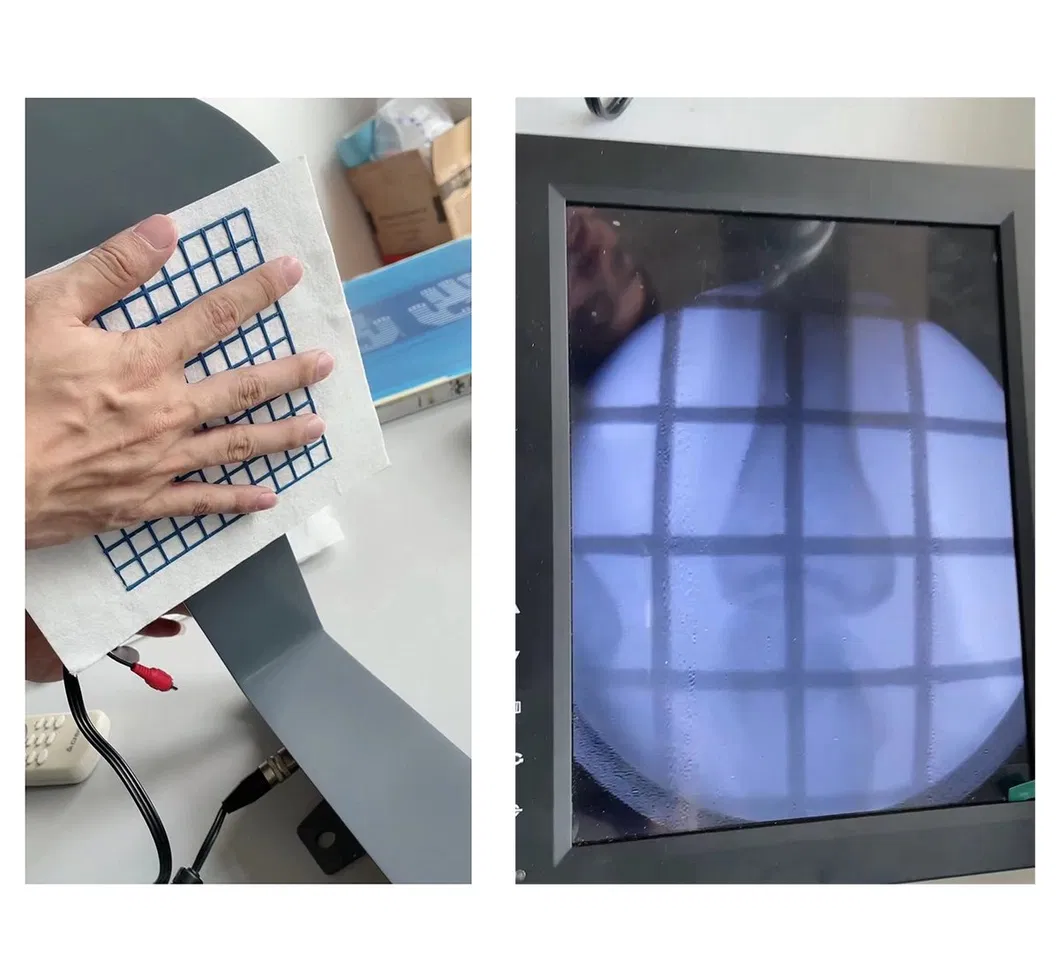 CT Biopsy Grid Image 2