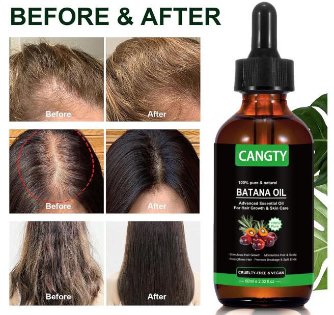 60ml Rosemary Hair Care Batana Oil Organic Herbal Essential Oil Vegan Moisturizing Keratin Featuring Rosemary