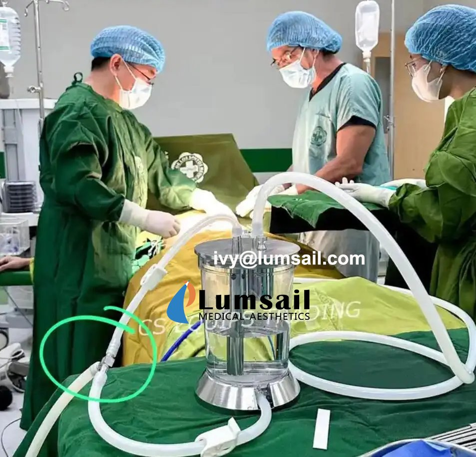 BS-Lips-FL1 Fat Transplantation and Filtering System Lipocollector