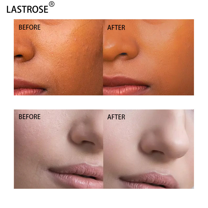 Foundation Shade 9