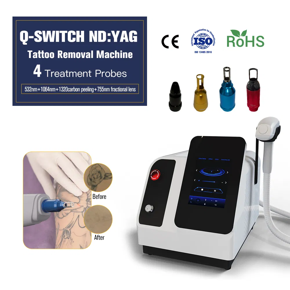Nubway Cost ND YAG Q Switched Laser Tattoo Removal Professional Portable ND YAG Laser Tattoo Removal Machine with Factory Price 1064nm 532nm Laser