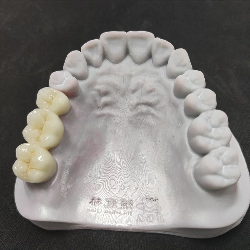 International Standard Monolithic Zirconia Crowns Chinese Dental Lab with High Aesthetic Quality for Oral Recovery