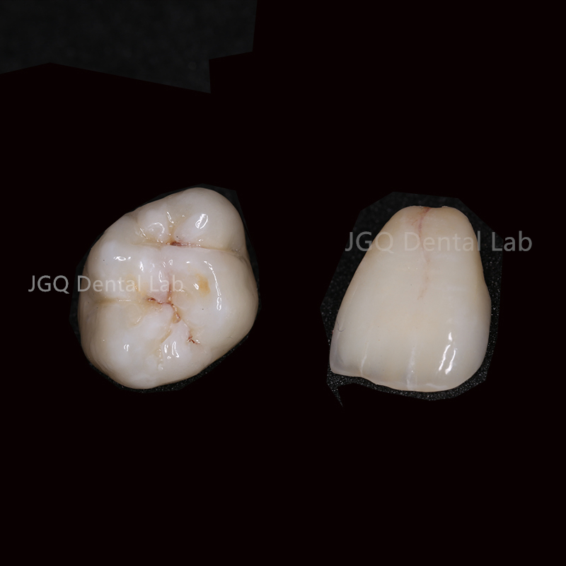 International Standard Monolithic Zirconia Crowns Chinese Dental Lab with High Aesthetic Quality for Oral Recovery