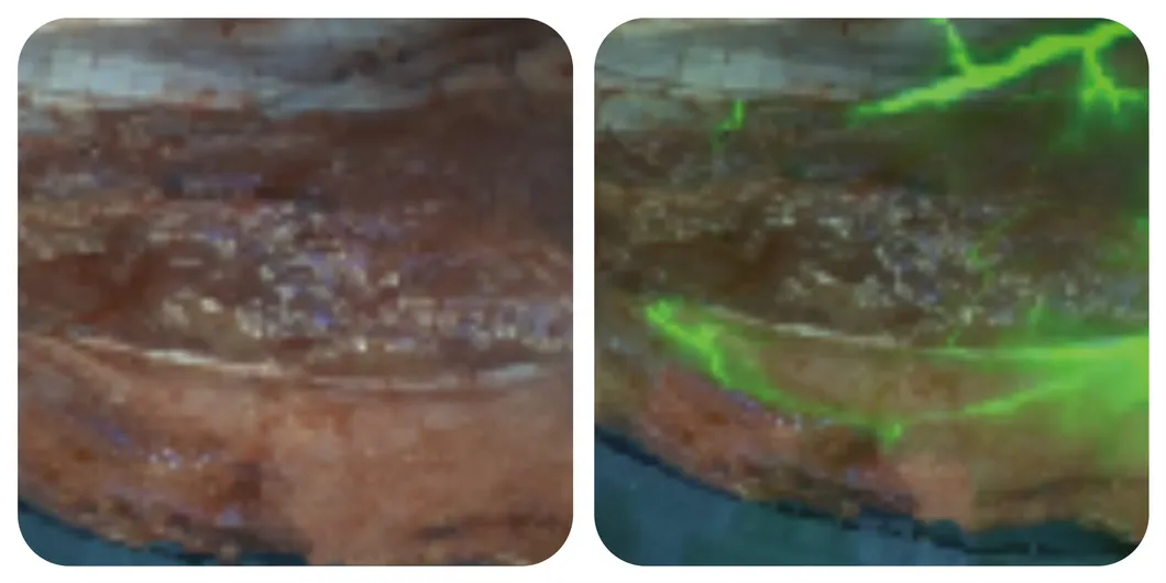 Blood supply evaluation