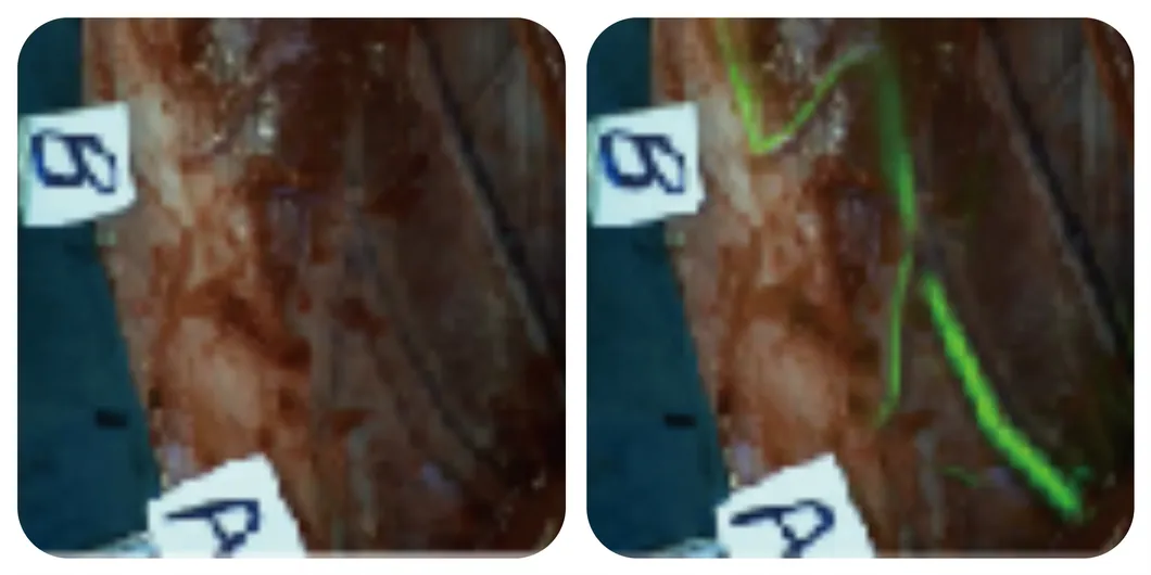 Blood supply evaluation