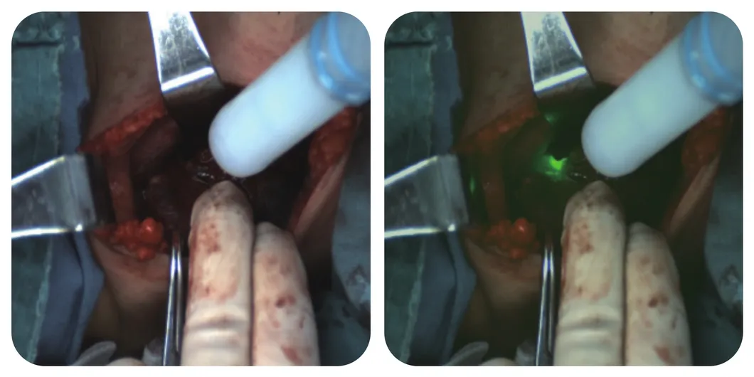 Gland identification