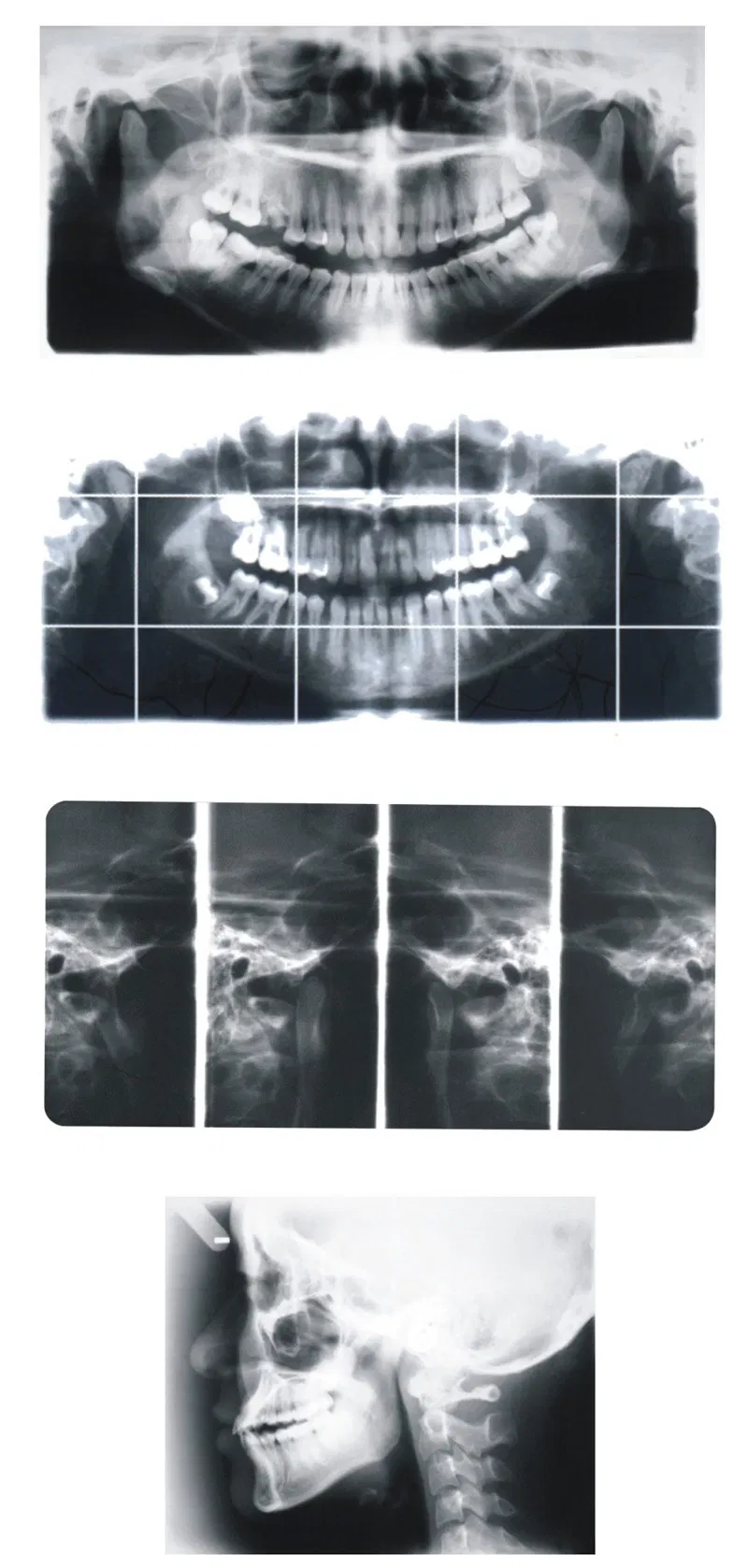 X-ray unit imaging height range