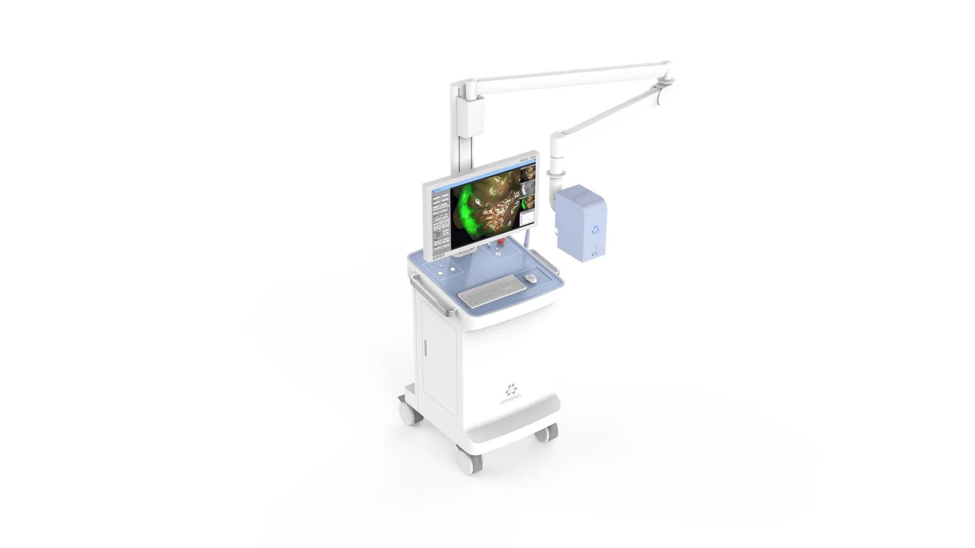 Surgical Fluorescence Lmaging System for Open Surgery