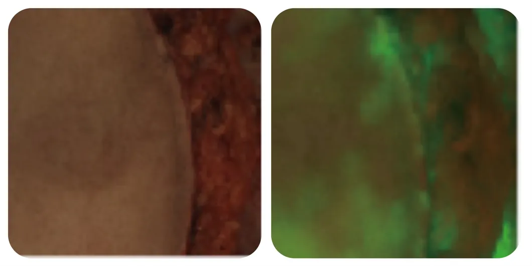 Blood supply evaluation