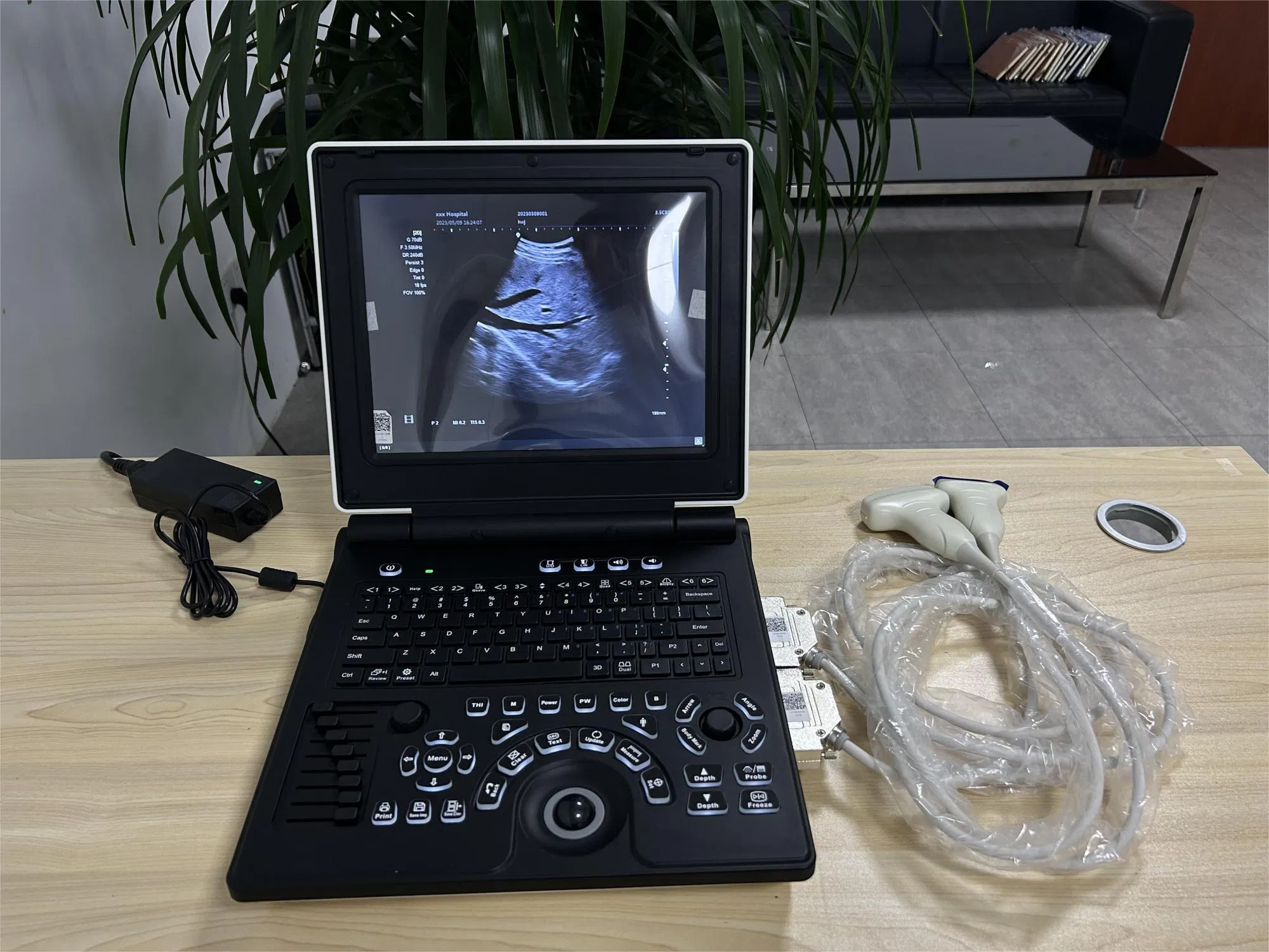 Portable Digital Ultrasound Machine-12"LED Display, 2 Probe Ports, Multi-Mode Imaging System