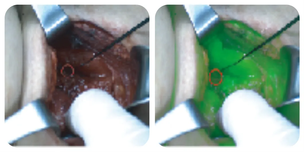 Functional evaluation