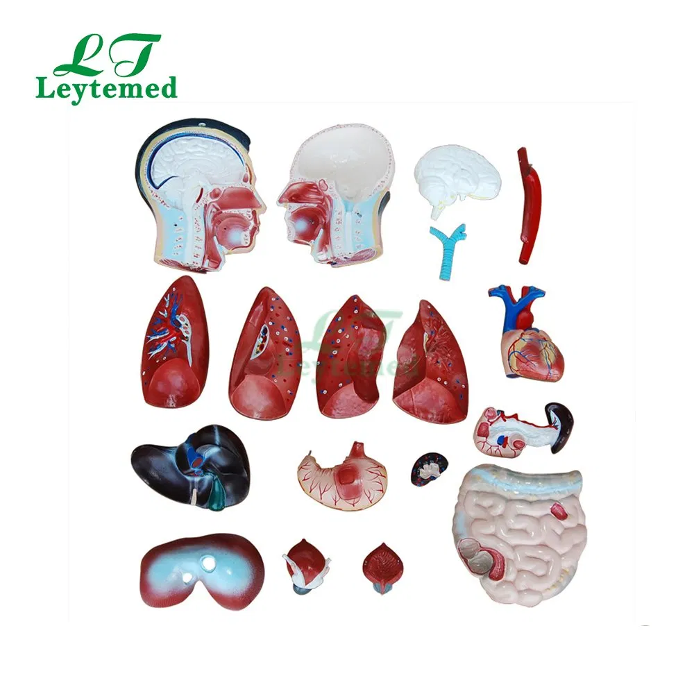 Ltm201 Anatomical Model 85cm Male Torso 19 Parts for Tranning