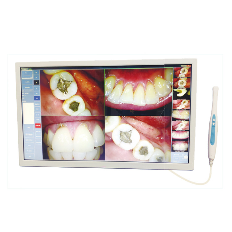 Sjd-I960 Quality Wireless Digital USB Touch Screen Dental Intraoral Camera with Monitor for Dental Clinic
