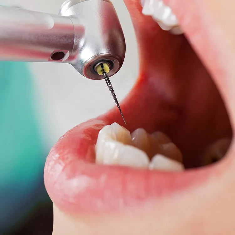 Dental Rotary Files 6