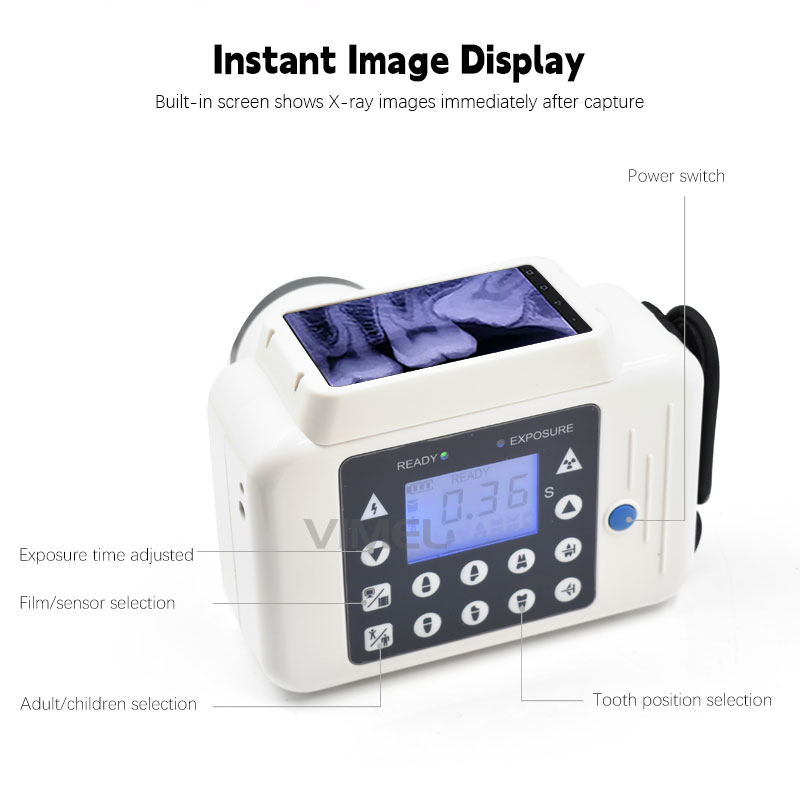 Portable Dental Equipment X-ray Instant Camera with Wireless Intraoral Sensor