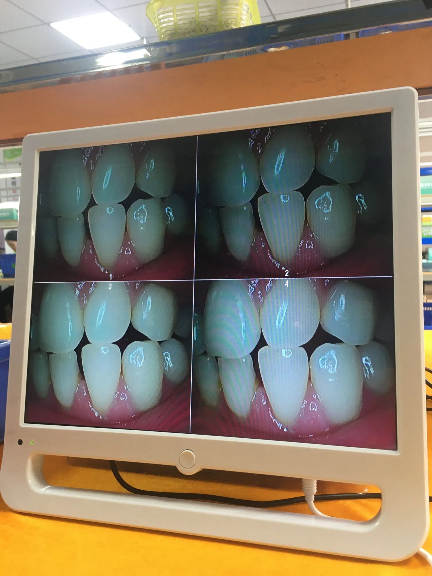 Hot Sale! ! ! Only 160$ All-in-One Dental Intra Oral Camera 12 Million Piexl with CE