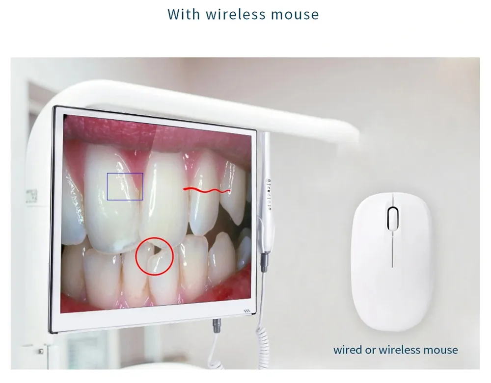 Intra Oral Camera View 6