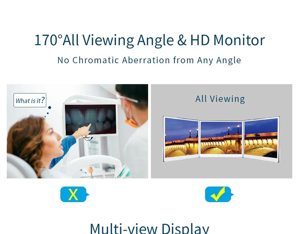 Intra Oral Camera View 2