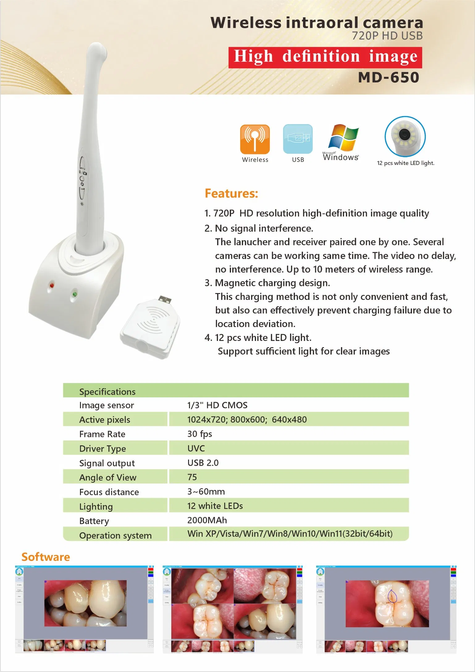2025 New Wireless Dental Intraoral Camera with Attractive Price