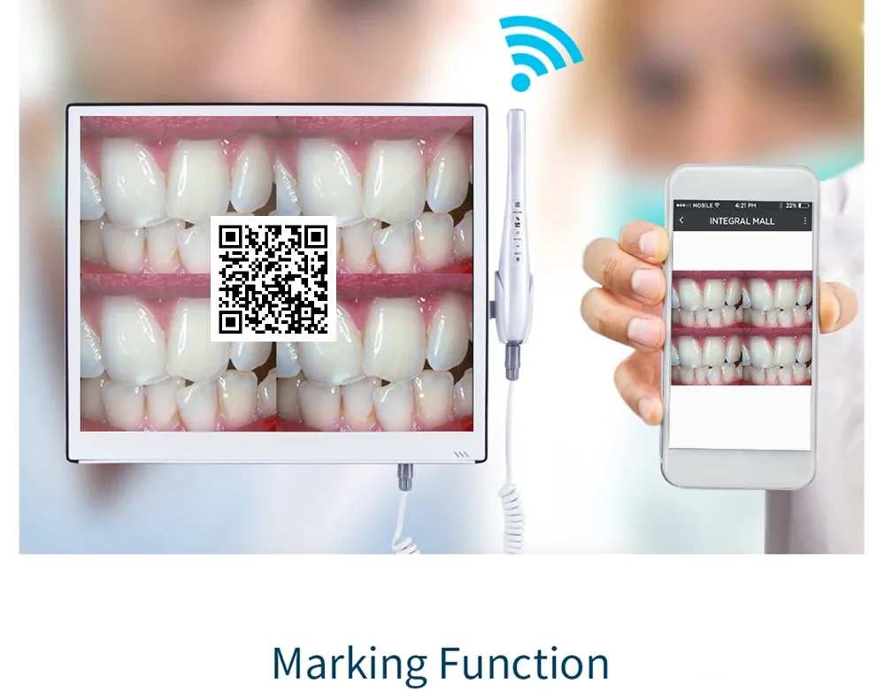 Intra Oral Camera View 5