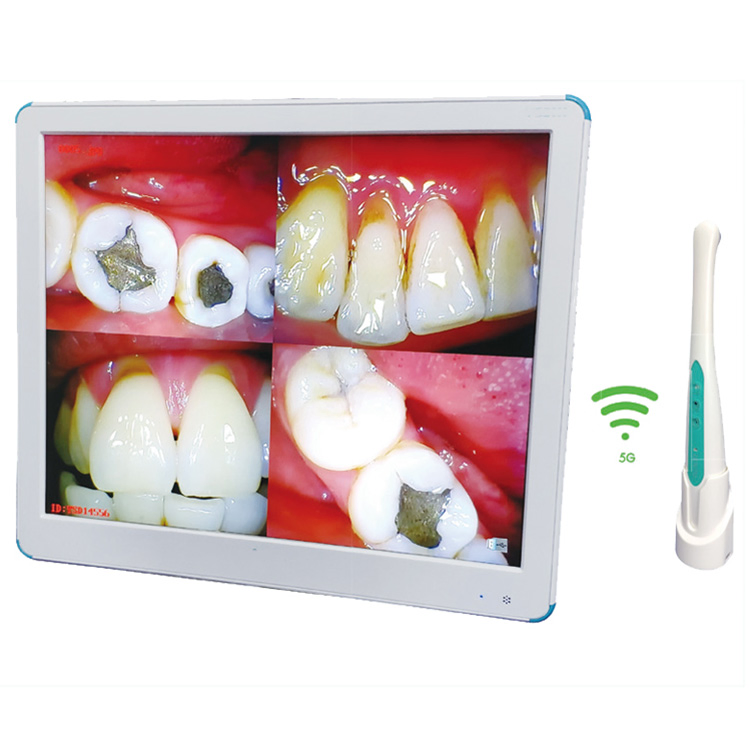 Sjd-I960 Quality Wireless Digital USB Touch Screen Dental Intraoral Camera with Monitor for Dental Clinic