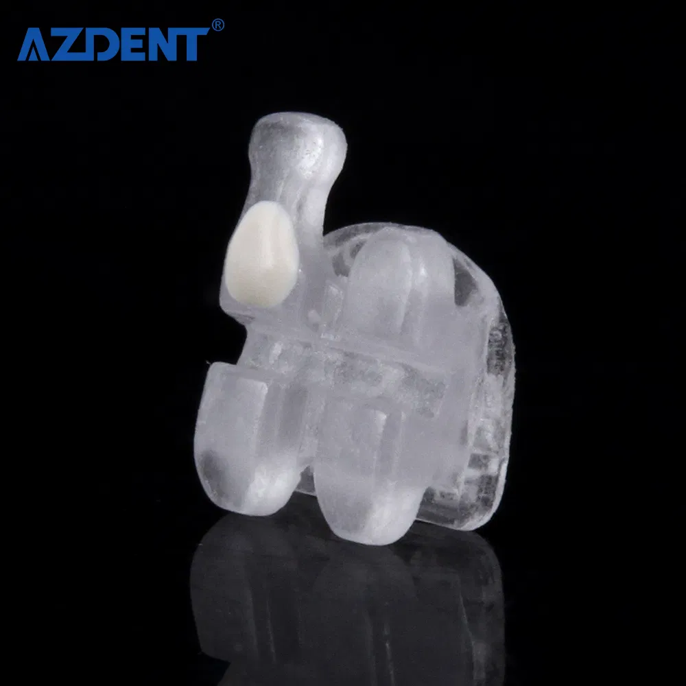 Ceramic Bracket Detail 5