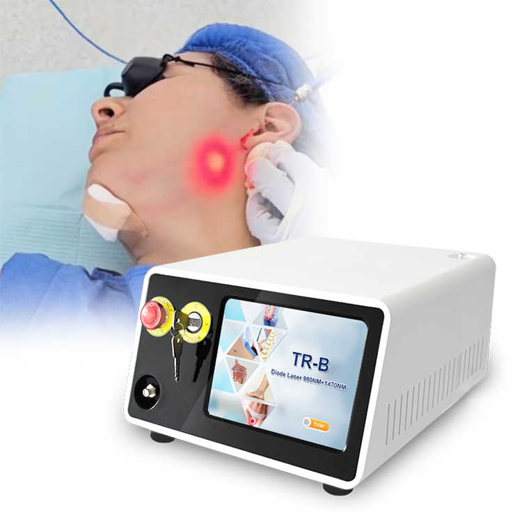Medical 1470nm 980nm Diode Laser Lipolysis Fat Removal Laser Ablation Therapy Endolift Laser Machine
