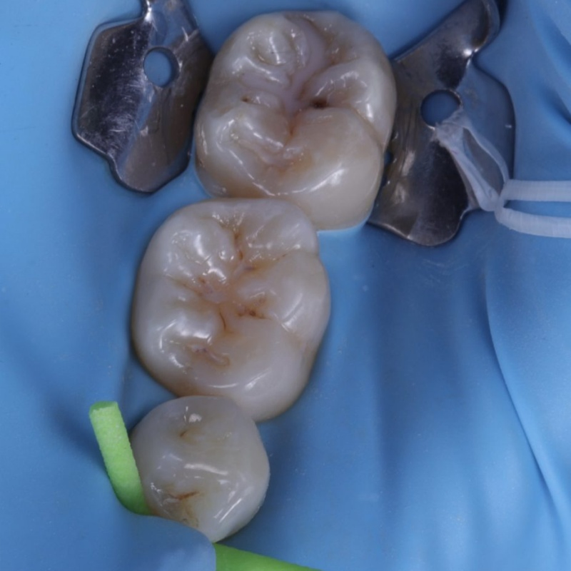 Low Price Rubber Dam Clamp Dental Rubber Dam Kit