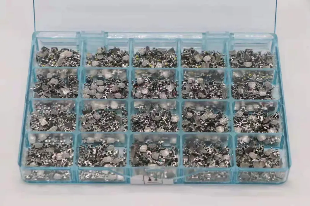 Orthodontic Detail 2