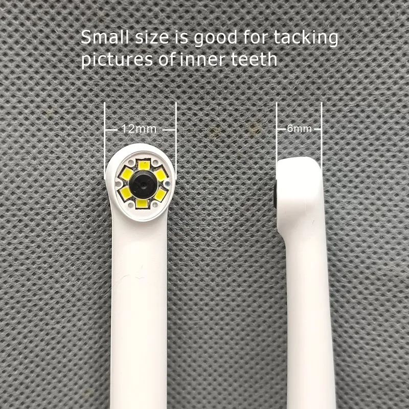 Intraoral Camera Detail 1