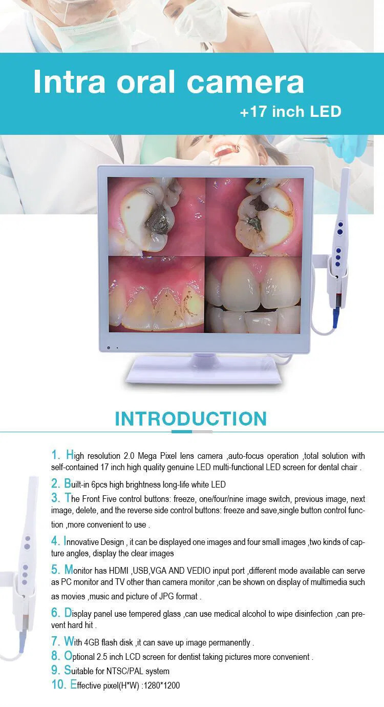 Intraoral Camera View 1