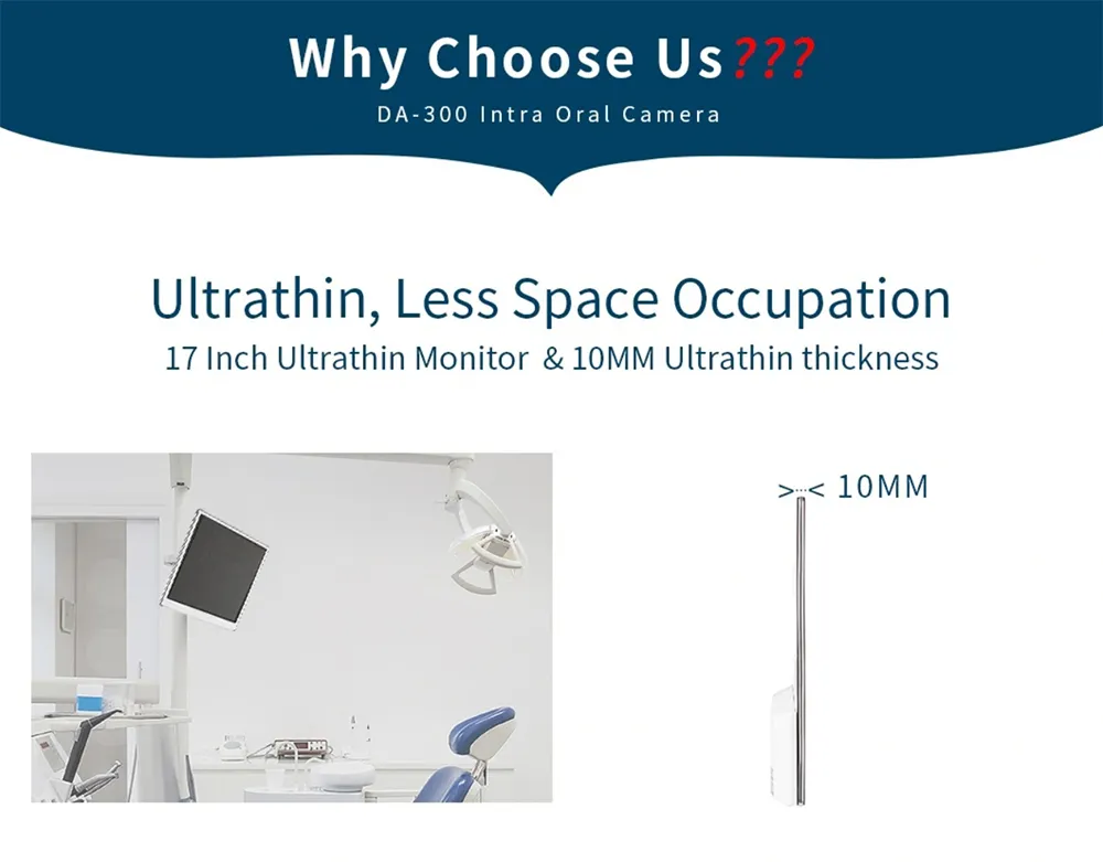 Intra Oral Camera View 1